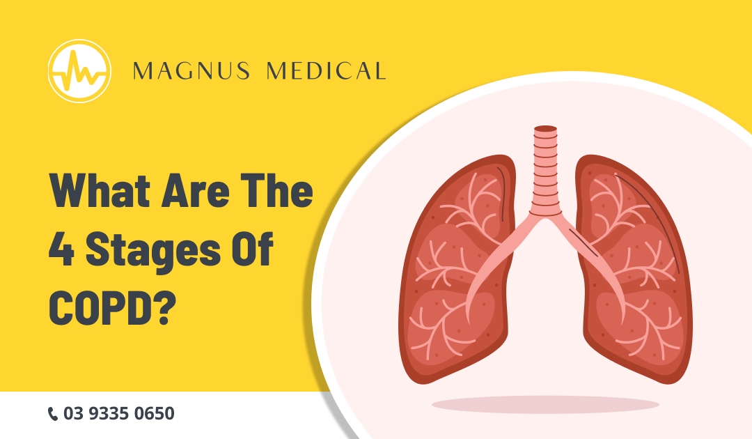 What are the 4 Stages of COPD