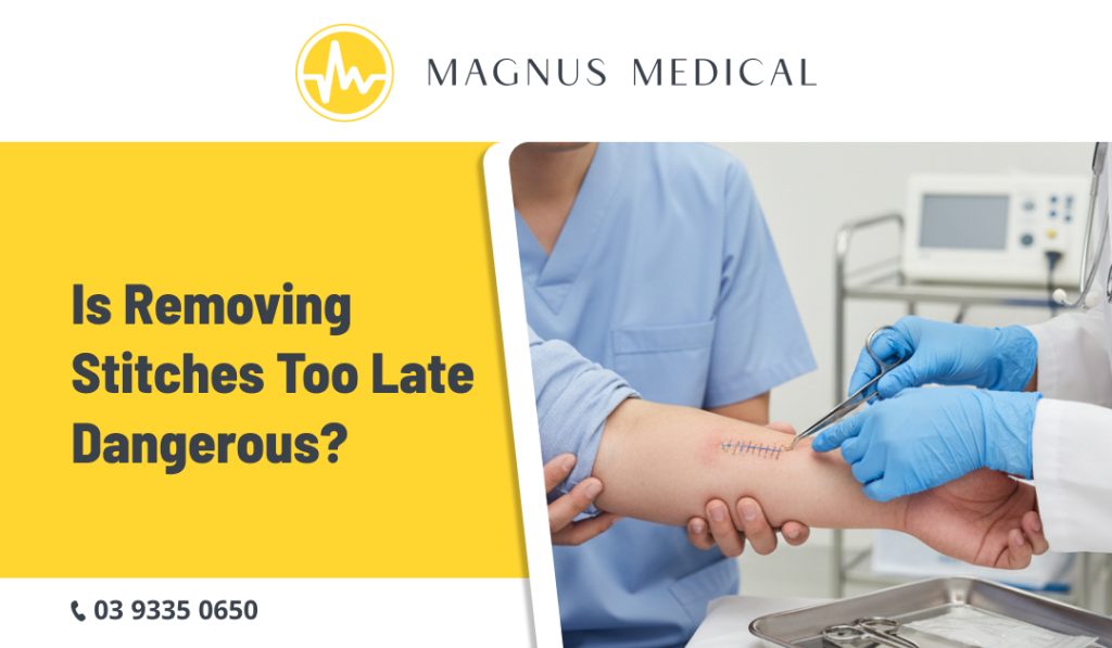 Is Removing Stitches Too Late Dangerous