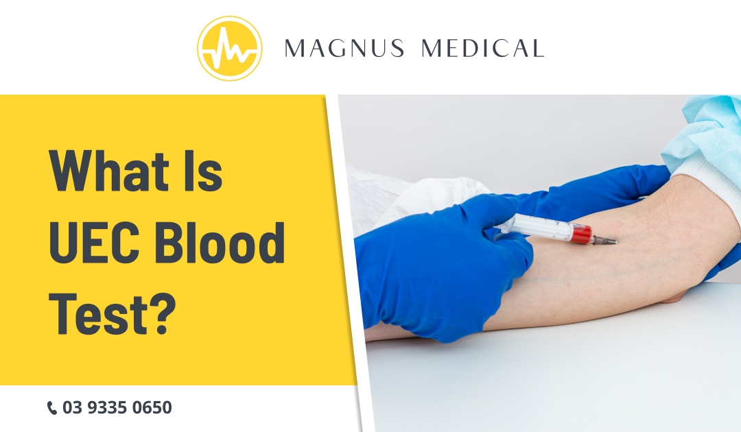 What is UEC Blood Test