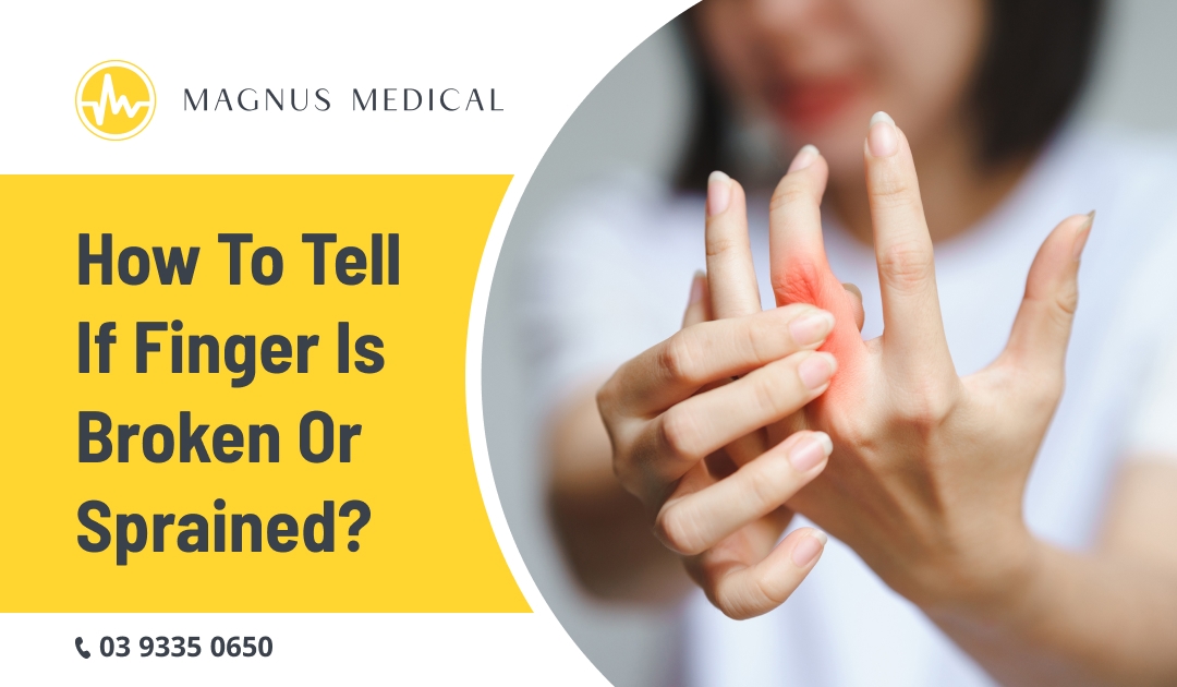 How To Tell If Finger Is Broken Or Sprained