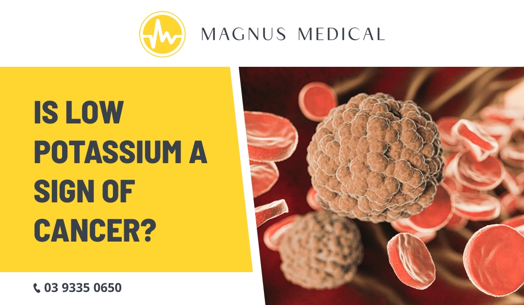 Is Low Potassium a Sign of Cancer