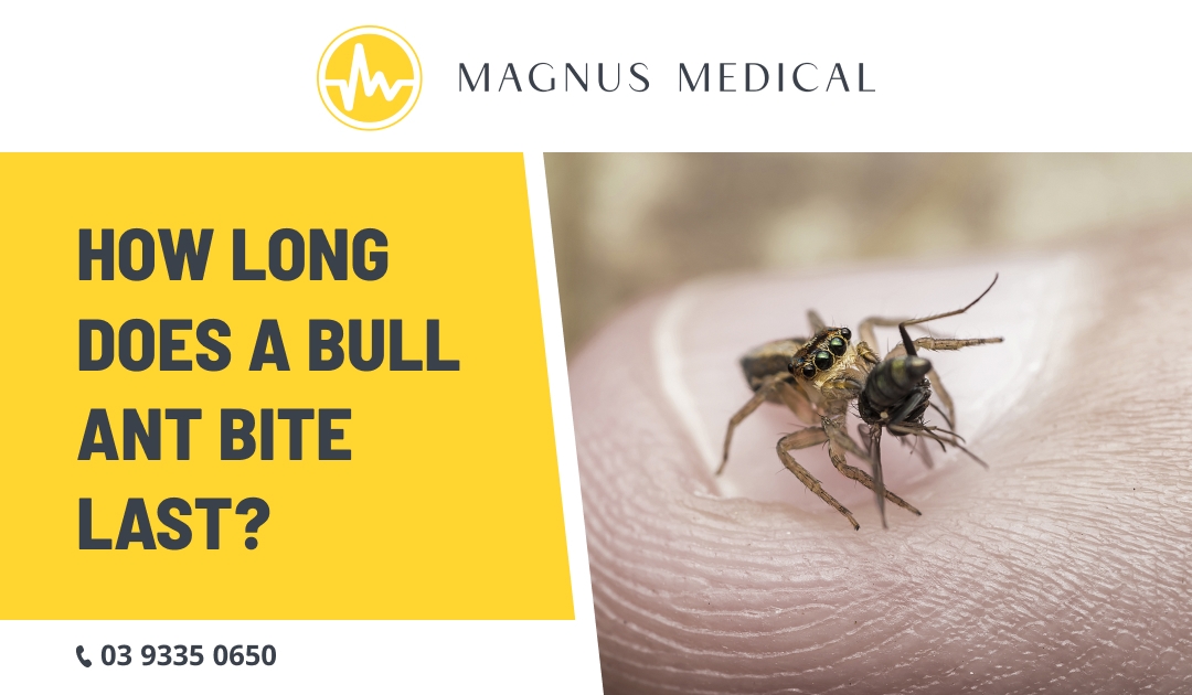 How Long Does A Bull Ant Bite Last
