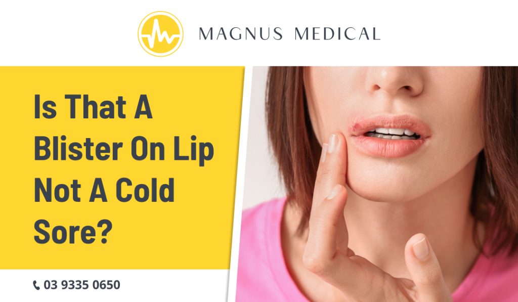Is That a Blister on Lip Not a Cold Sore