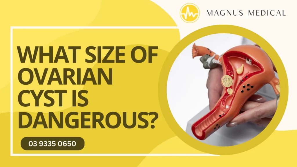 What Size of Ovarian Cyst is Dangerous