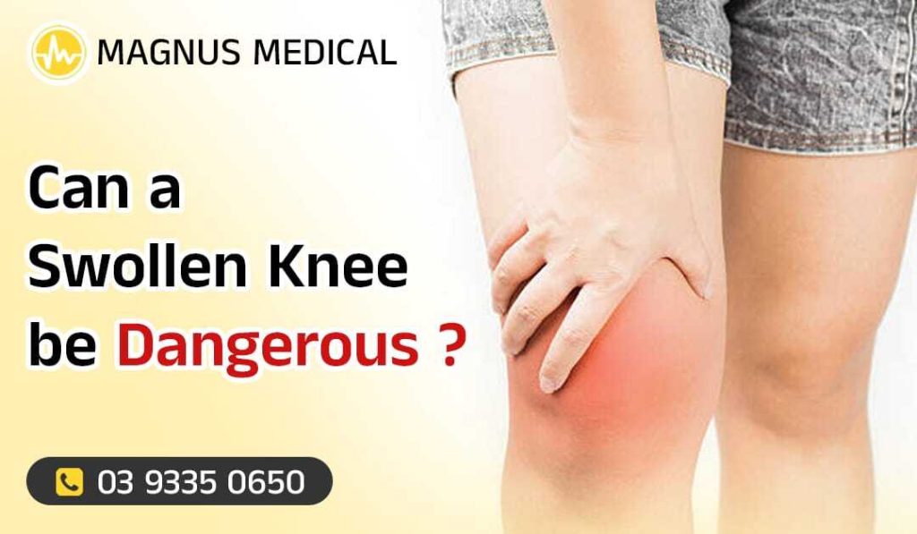 Can A Swollen Knee Be Dangerous