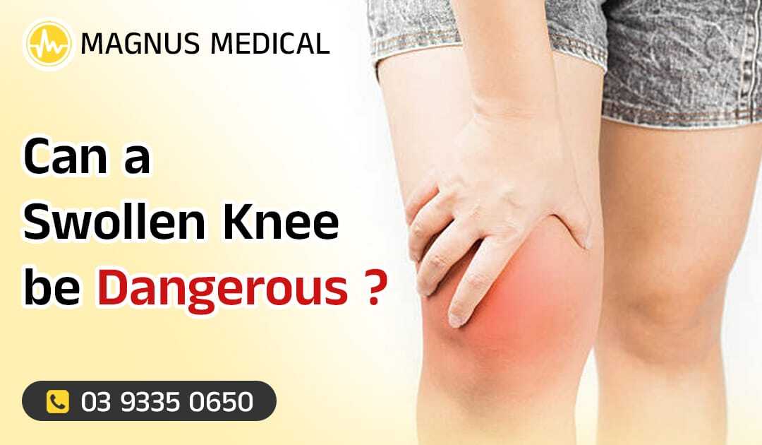 Can A Swollen Knee Be Dangerous