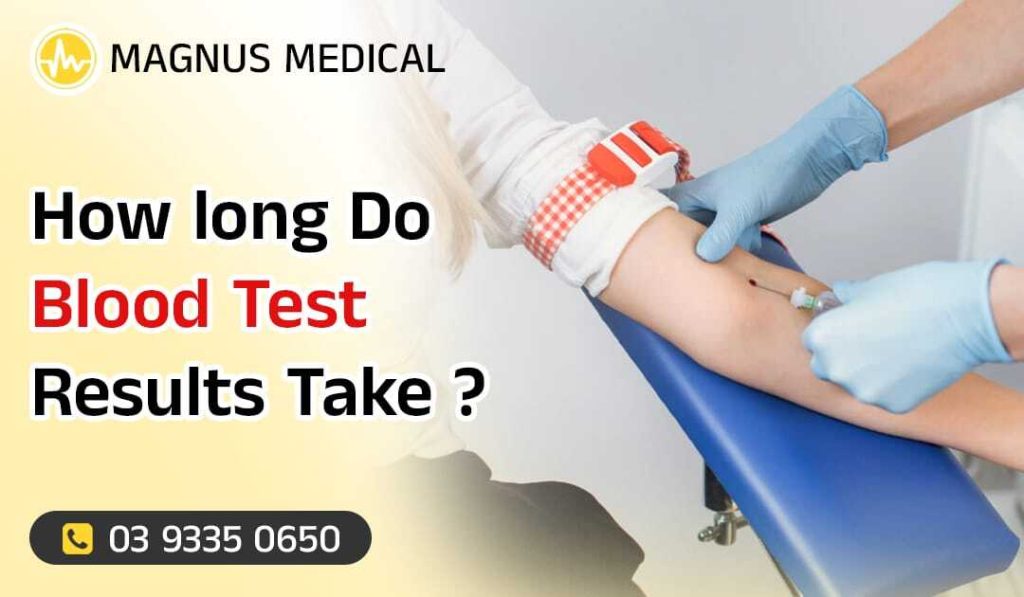 How Long Do Blood Test Results Take
