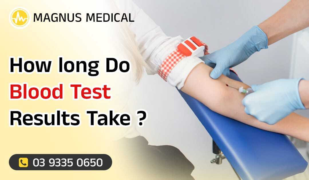 How Long Do Blood Test Results Take