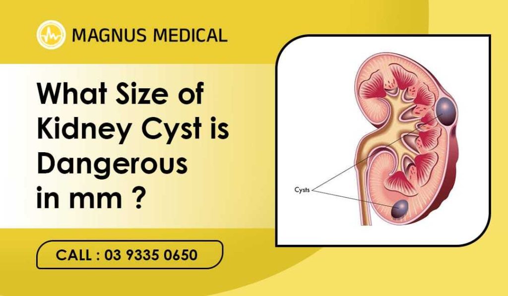 What Size of Kidney Cyst is Dangerous in mm