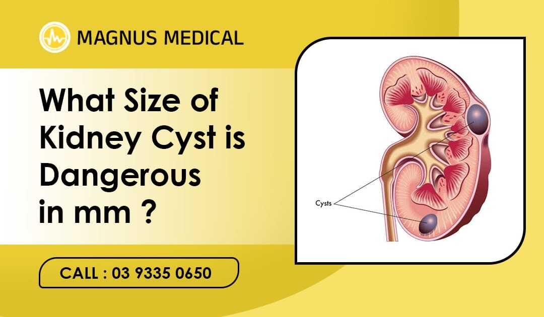 What Size of Kidney Cyst is Dangerous in mm