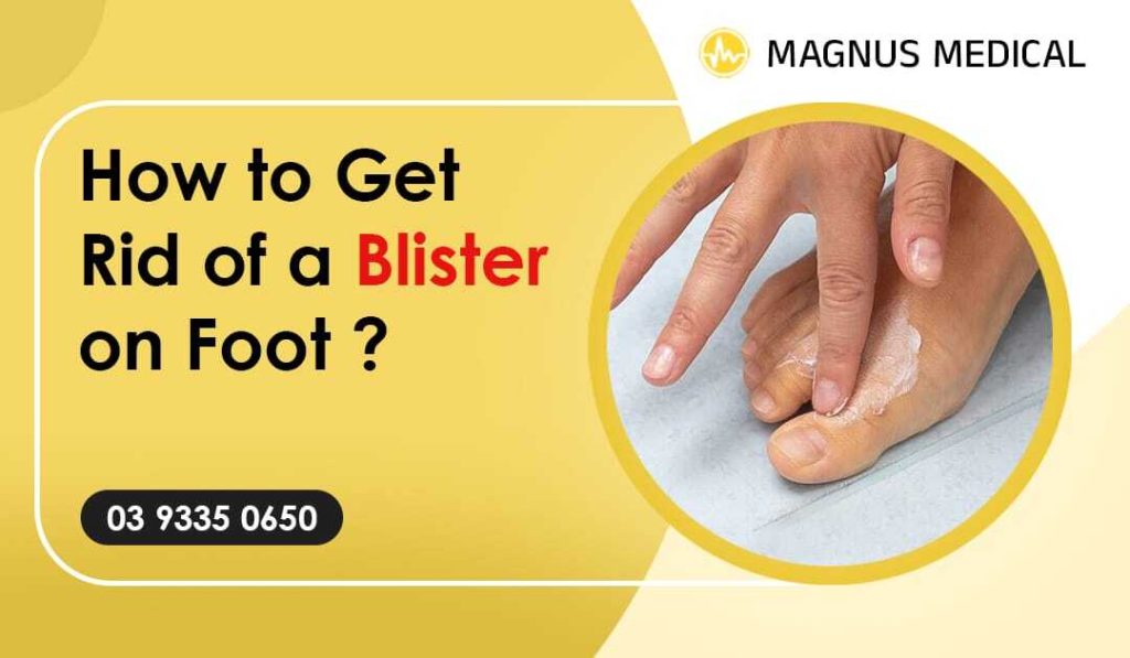 How To Get Rid of a Blister on Foot