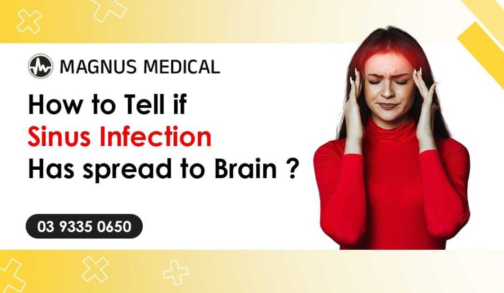 How to Tell If Sinus Infection Has Spread to Brain