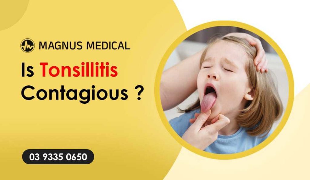 Is Tonsillitis Contagious