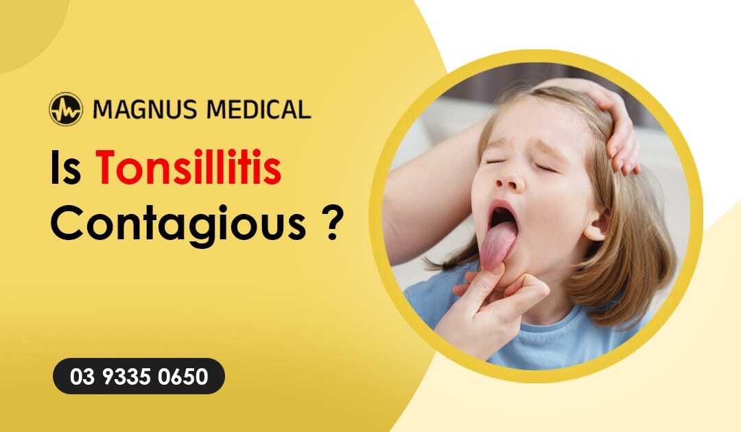Is Tonsillitis Contagious