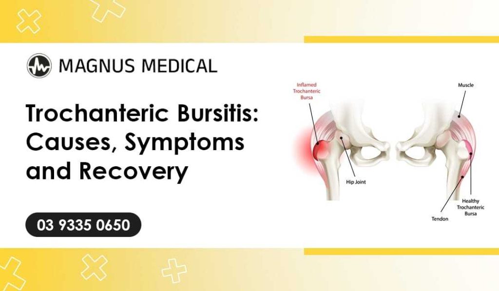 Trochanteric Bursitis