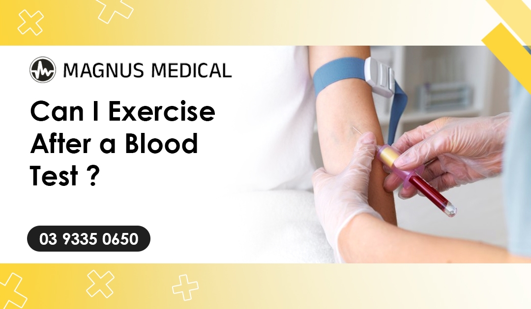 Can I Exercise After a Blood Test