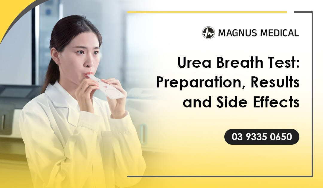 Urea Breath Test