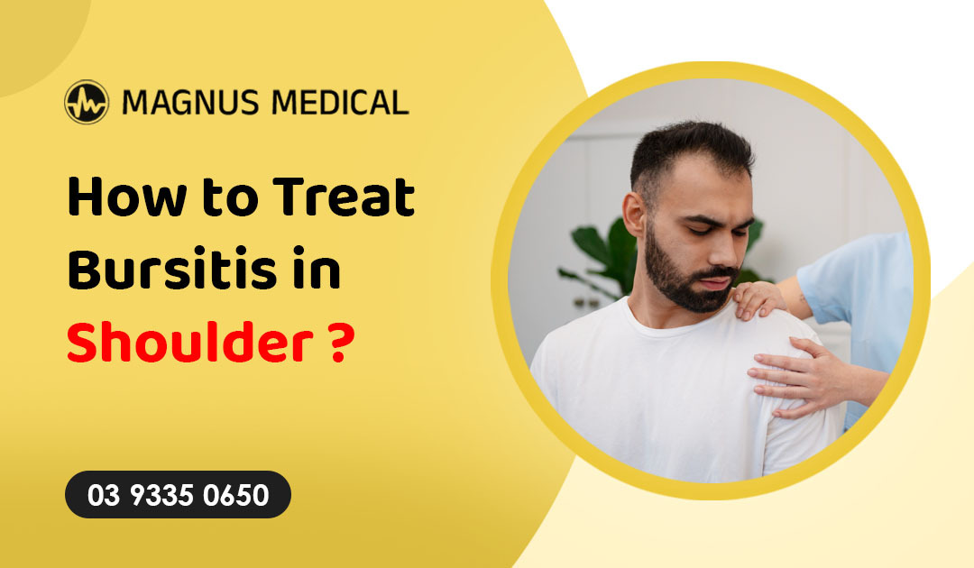 How to Treat Bursitis in Shoulder