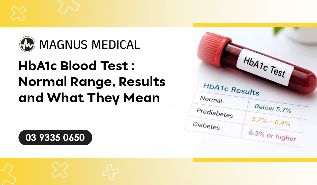 HbA1c Blood Test