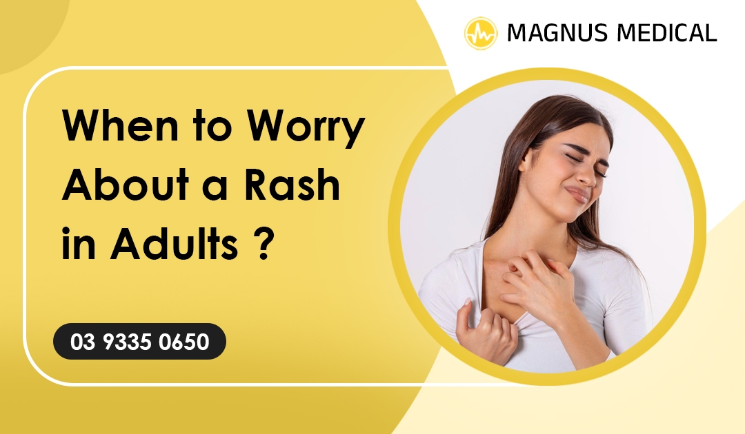 When to Worry About a Rash in Adults